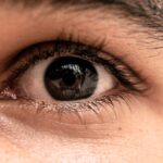 Alles wat je moet weten over ooglidcorrectie
