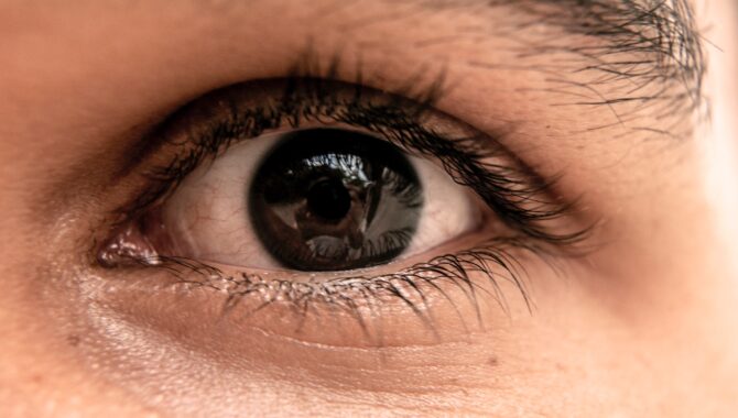 Alles wat je moet weten over ooglidcorrectie