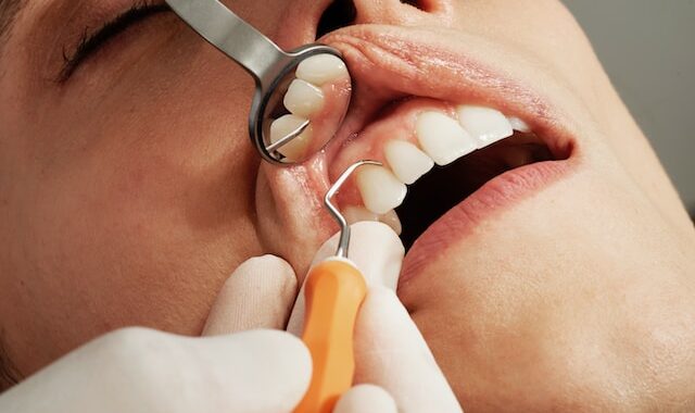 Alles wat je moet weten over tandartspraktijken in Zoetermeer